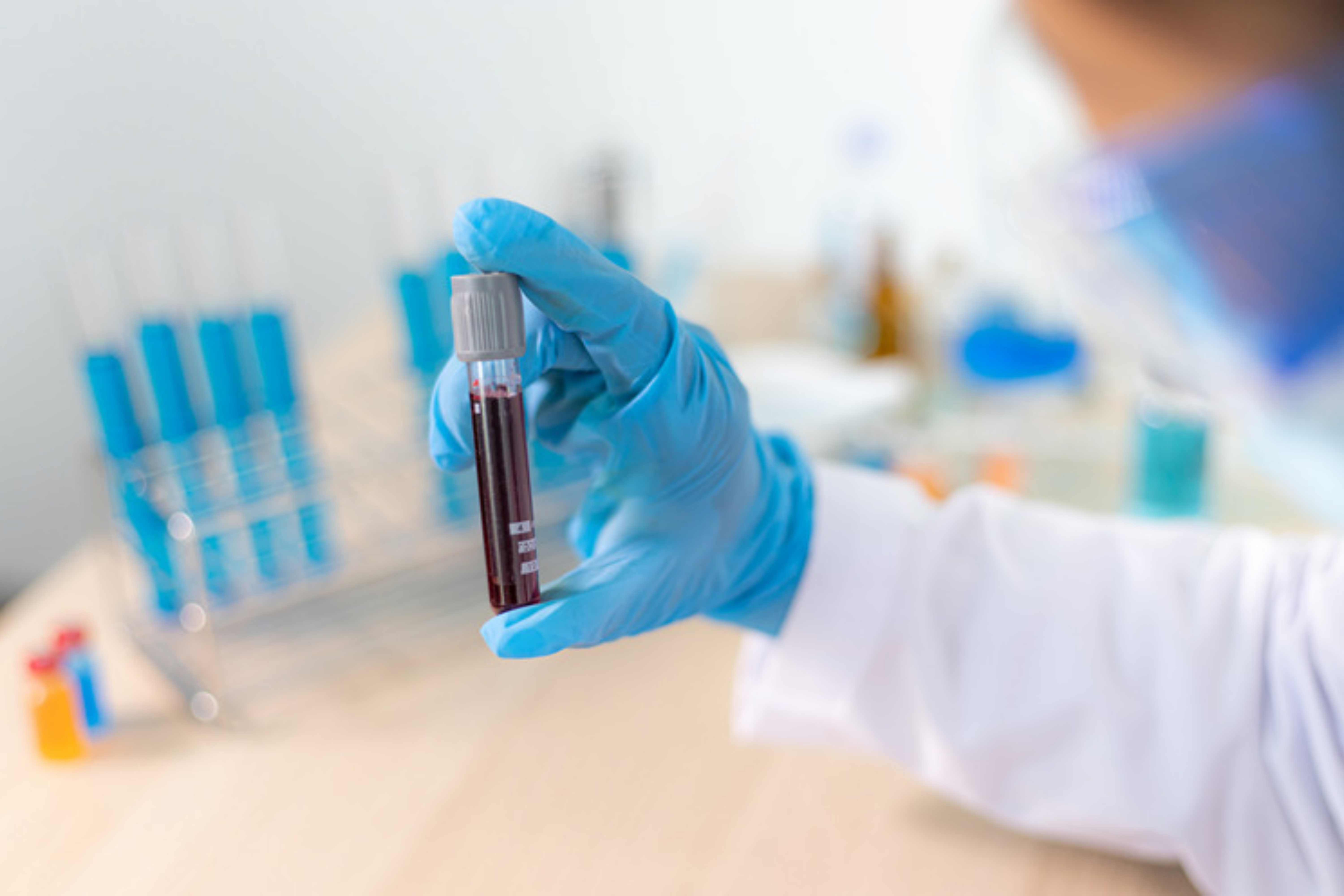 Konflikt serologiczny w ciąży: jak uniknąć zagrożenia dla płodu?