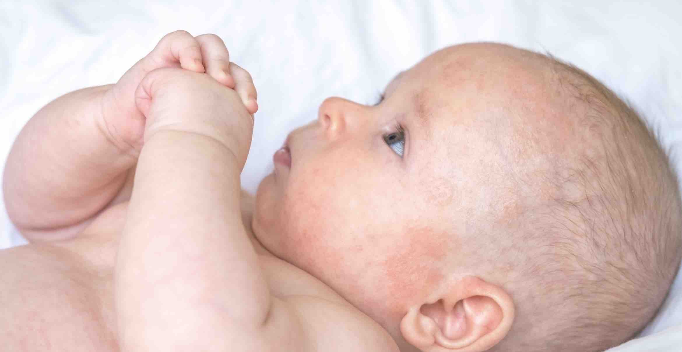 elfbar nachfüll pod läuft aus Urticaire – Asthme et Allergies et Urticaire